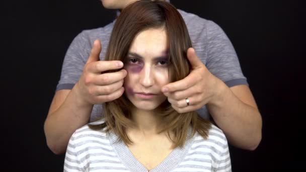 A young man removes hair from the face of a young woman and strokes it. A woman with bruises on her face. Quarrel in a young family. Domestic violence. On a black background — Stock Video