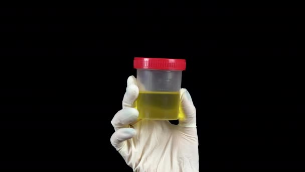 Urine in een testpot close-up. De dokter houdt een pot in een handschoen op een zwarte achtergrond. — Stockvideo