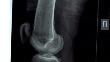 Diz ekleminin yakın plan röntgeni. Tepeden tırnağa X-ray resmi