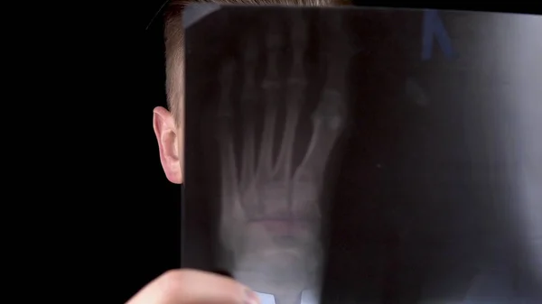 Il dottore controlla i risultati di una radiografia del piede. Un uomo sta considerando una radiografia da vicino. Su uno sfondo nero. Vista attraverso un'immagine a raggi X . — Foto Stock