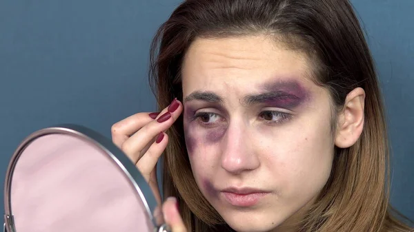 Una giovane donna esamina i lividi sul viso nello specchio. Litigi in una giovane famiglia. Violenza domestica. Da vicino. — Foto Stock