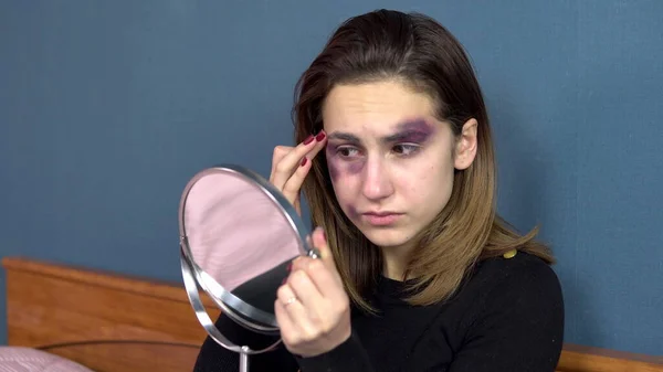 A young woman examines bruises on her face in the mirror. Quarrels in a young family. Domestic violence. The girl is sitting on the bed — Stock Photo, Image