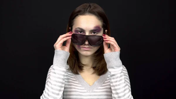 Eine junge Frau nimmt ihre Sonnenbrille ab, um blaue Flecken im Gesicht zu zeigen. eine Frau mit blauen Flecken im Gesicht. Streit in einer jungen Familie. Häusliche Gewalt. auf schwarzem Hintergrund — Stockfoto