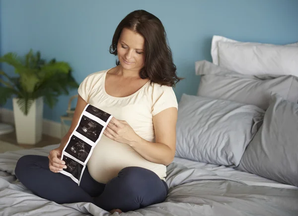 Mulher grávida navegando imagem de ultra-som — Fotografia de Stock