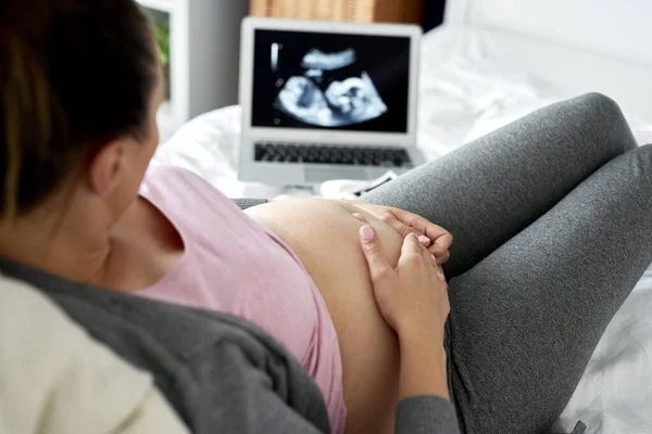Kobieta Ciąży Ogląda Ultradźwięki Komputerze — Zdjęcie stockowe