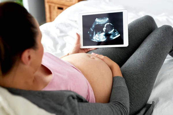 Беременная Женщина Смотрит Ультразвук Планшете — стоковое фото