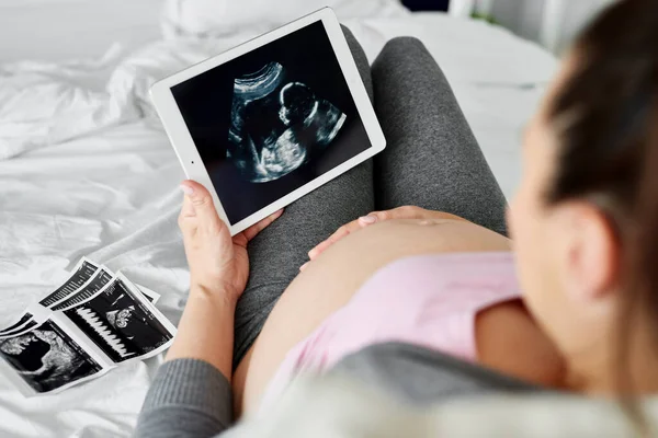 妊娠中の女性のタブレット上で超音波画像を閲覧の背面図 — ストック写真