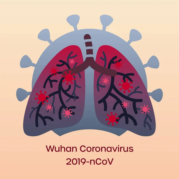 Infecção pelo coronavírus da China nos pulmões. Ilustração plana simples —  Vetores de Stock