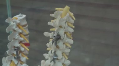 Cam bir kutuda duran metal protezli insan omurgası protezleri.