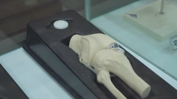 ガラス製の箱の中に金属製の義肢のある人間の膝の義肢の例 — ストック動画
