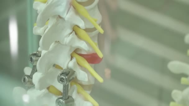 Contoh Tulang Belakang Prostetik Manusia Dengan Kaki Palsu Logam Berdiri — Stok Video