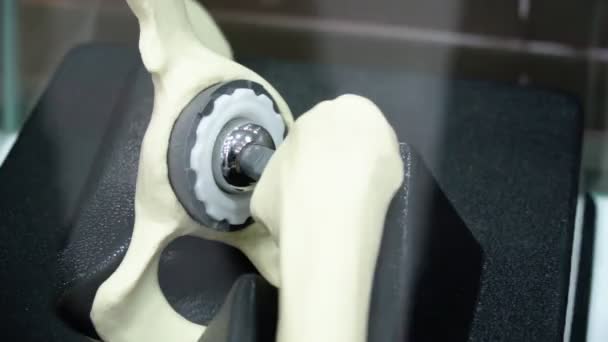 Przykład Ludzkiej Protezy Udowej Metalowymi Protezami Stojącymi Szklanym Pudełku — Wideo stockowe