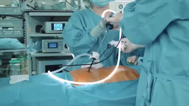 几个有手术室的医生用腹腔镜手术 — 图库视频影像