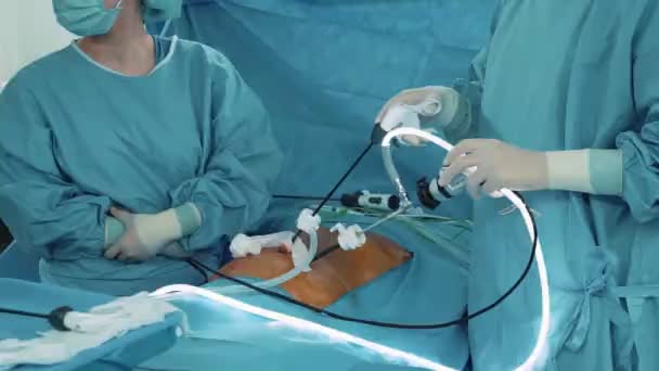 수술실을 가지고 의사들 복강경으로 수술하는 — 비디오