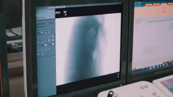 Nowoczesna Sala Przedoperacyjna Której Lekarze Sprawdzają Monitory Danymi Biometrycznymi Pacjencie — Wideo stockowe