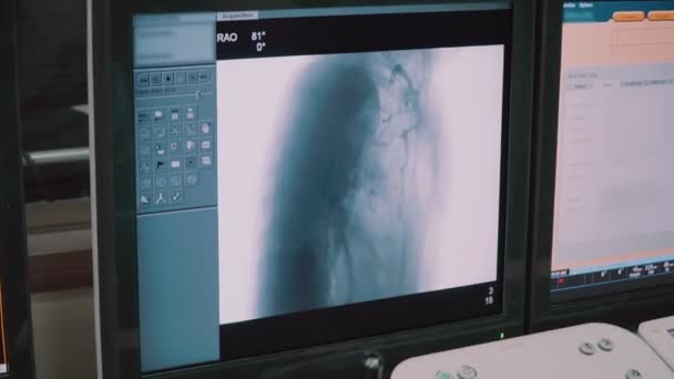 Moderna Sala Operatoria Medica Cui Medici Esaminano Monitor Con Dati — Video Stock