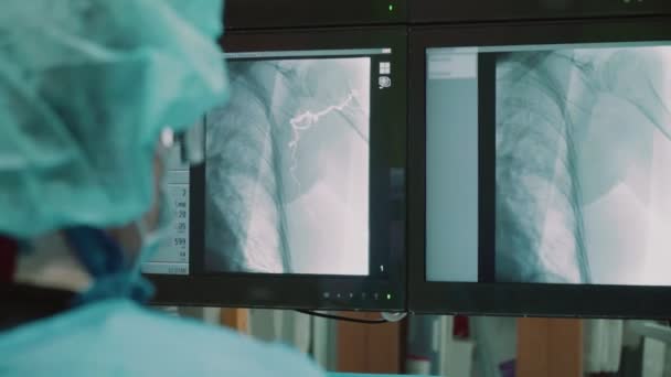 Современная Медицинская Операционная Которой Врачи Проводят Операцию Глядя Мониторы Биометрическими — стоковое видео