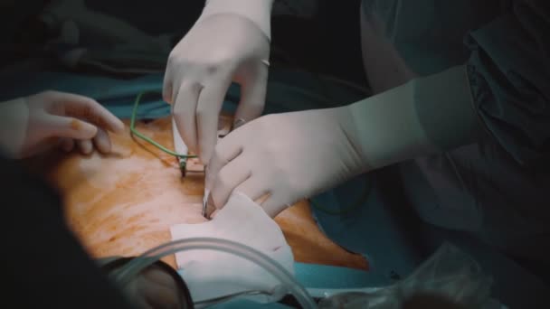 Moderní Operační Sál Kterém Lékař Provádí Otvírání Dutiny Břišní Pro — Stock video