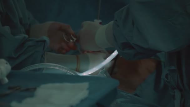 Operation Laparoscopic Method Several Doctors Operating Room — Stock Video