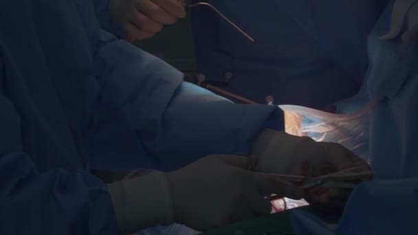 外科医は手術室で手術を受ける人の頭蓋骨に手術を行います — ストック動画