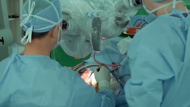 Chirurg Wykonuje Operację Ludzkiej Czaszce Przez Mikroskop Elektronowy Sali Operacyjnej — Wideo stockowe
