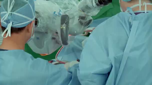 Cirurgião Realiza Cirurgia Crânio Humano Através Microscópio Eletrônico Sala Cirurgia — Vídeo de Stock