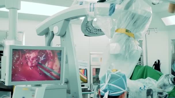 Chirurgie Crâne Humain Microscope Électronique Salle Opération Avec Image Sur — Video