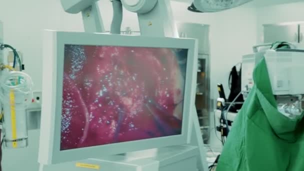 外科医生在手术室用电子显微镜对人体颅骨进行外科手术 用监视器显示图像 — 图库视频影像