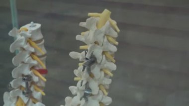 Cam bir kutuda duran metal protezli insan omurgası protezleri.