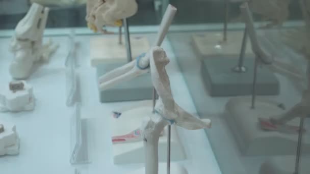 Ejemplo Prótesis Columna Vertebral Humana Con Prótesis Metálicas Pie Una — Vídeo de stock