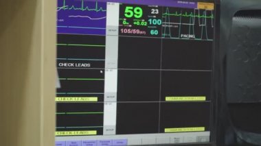 Ekranda hastanın hayati göstergeleri ve kalp atışları görülüyor.