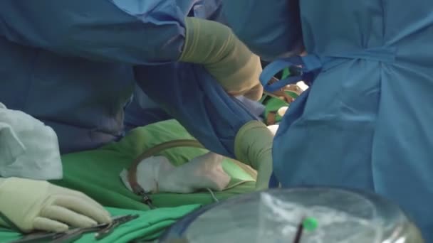 Team Doctors Surgeons Perform Surgery Installing Prosthetic Knee Joint — Stock Video