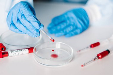 Coronavirus. Doktor, hemşire, koruyucu kıyafetli bilim adamı ve maske takmış bir tüpü biyolojik numuneyle test ediyor. Corona virüsü ile kirlenmiş bir şırınga. Laboratuar testi - Pozitif sonuç.
