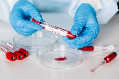 Salgın Corona virüsü. Doktor kan testi yapıyor, pozitif sonuç, hızla yayılan Coronavirüs, Çin. 2019 nCoV için kan örneği içeren tüp..