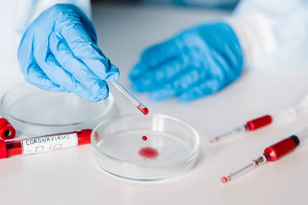 Koronavírus Doktor Nővér Tudós Védőruhában Maszk Tesztel Egy Csövet Biológiai — Stock Fotó