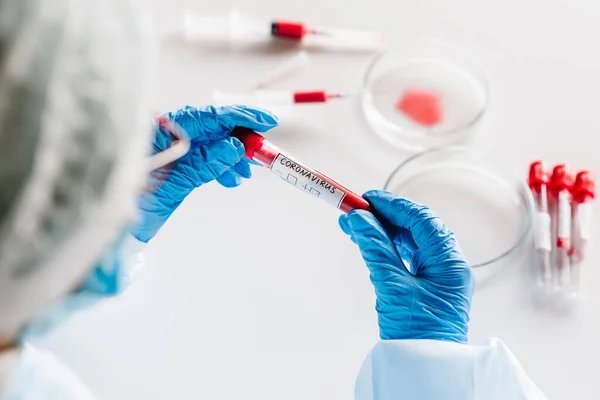 Salgın Corona Virüsü Doktor Kan Testi Yapıyor Pozitif Sonuç Hızla — Stok fotoğraf
