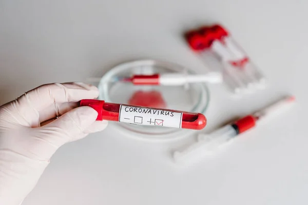 Hand Håller Röret Med Provblod För 2019 Ncov Coronavirus Läkare — Stockfoto