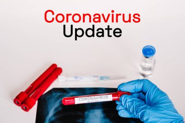 Coronavirus güncelleme metni. Bir doktor, arka plan röntgen filminde biyolojik kan örneği içeren test tüpü, hastalık ve şırınga aşısı tutuyor. Hasta sağlığı hakkında tıbbi teşhis.
