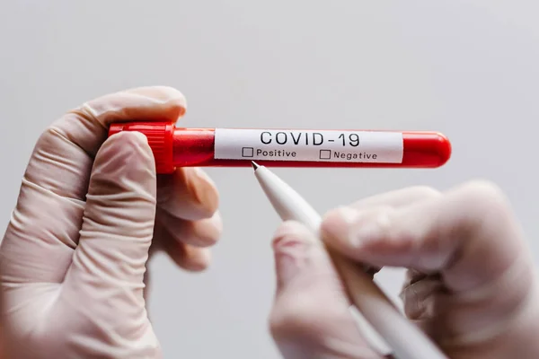Coronavirus. Doktorun elleri, hemşire kalemle bir not yazıyor, hastaların kan örneklerini laboratuarda tutuyor. SARS-Cov-2. Laboratuvar testleri negatif sonuç verdi.