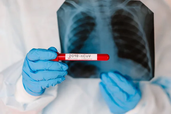 Médico Especialista Medicina Pulmonar Con Radiografía Tórax Radiológica Para Diagnóstico — Foto de Stock