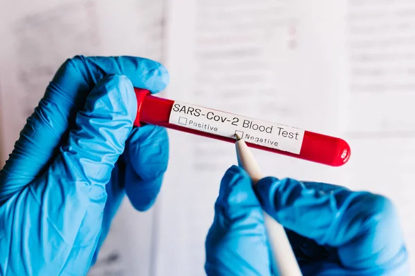 Coronavirus 医生的手 护士用笔写着便条 在实验室里拿着装有病人血液样本的管子 Sars Cov 进行实验室检测阴性结果 — 图库照片