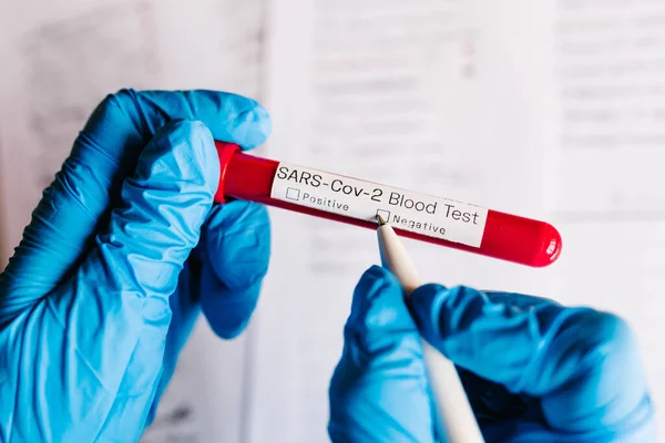 Coronavirus. Doktorun elleri, hemşire kalemle bir not yazıyor, hastaların kan örneklerini laboratuarda tutuyor. SARS Cov 2. Laboratuvar testleri negatif sonuç verdi.