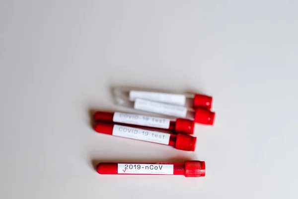 Коронавірус Біологічні Зразки Крові Пробних Трубках Лежать Білому Тлі 2019 — стокове фото