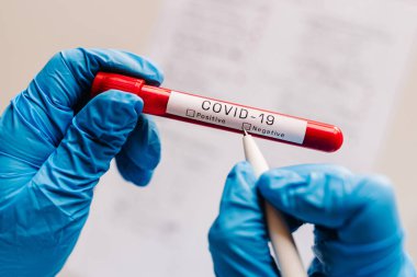 Covid-19 mesajı. Doktorun, hemşirenin, bilim adamının elleri kalemle yazıp, negatif sonucu onaylıyor. Biyolojik numuneyle birlikte bir test tüpü tutuyor. Coronavirus. Kan enfeksiyon kapmaz. Yeni tedavi vakaları.