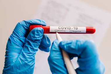 Coronavirus. Doktorun elleri, hemşire kalemle bir not yazıyor. Laboratuvarda hasta kan örneği içeren bir tüp tutuyor. COVID-19. Laboratuvar testi yapın. Pozitif sonuç. 2019-nCoV virüsü.