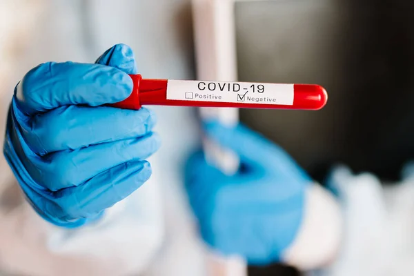 Coronavirus 医生的手 穿着防护服的护士拿着装有生物样品的试管 Covid 进行实验室测试 阴性结果 血液没有感染 新的治愈病例 — 图库照片