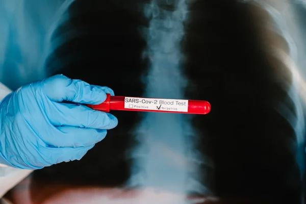 Médico Especialista Medicina Pulmonar Con Radiografía Tórax Radiológica Para Diagnóstico — Foto de Stock
