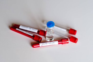 Coronavirus. Test tüplerindeki biyolojik kan örnekleri ve hastalığın aşısı beyaz arka planda. 2019-NCov. Laboratuvar testi olumlu sonuç verdi. Kan enfeksiyon kapmış. Yeni enfeksiyon vakaları. Güncelleme.