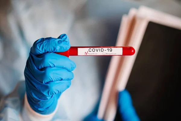 Coronavirus 医生的手 穿着防护服的护士拿着装有生物样品的试管 Covid 进行实验室检测结果呈阳性 血被感染了新感染病例 — 图库照片