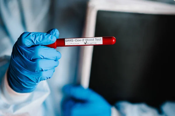 Coronavirus 一位身着防护服的医生 科学家的手拿着一个装有生物样品的试管 Sars Cov 进行实验室测试 阴性结果 今天的新闻是最新消息 — 图库照片